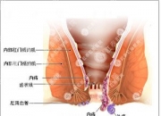 肛门放跳蛋什么感觉(肛门里面跳)（肛门蹦蹦跳是什么症状）